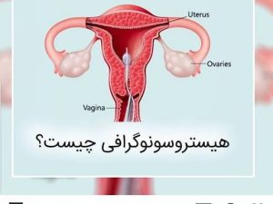 دربارۀ این مقاله بیشتر بخوانید هیستروسونوگرافی چیست؟